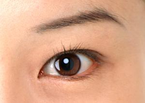 心斎橋で注目の美容クリニックといえば？